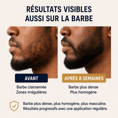 Bodywise – Sérum de Croissance Cheveux & Barbe