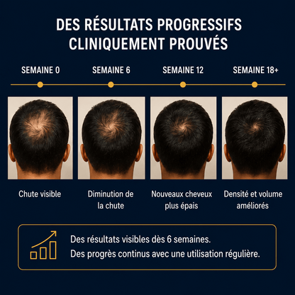Bodywise – Sérum de Croissance Cheveux & Barbe