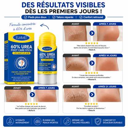Podovia™ – Stick Réparateur Pieds Secs & Talons Fissurés